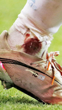 Berdarah Demi Gelar Perdana